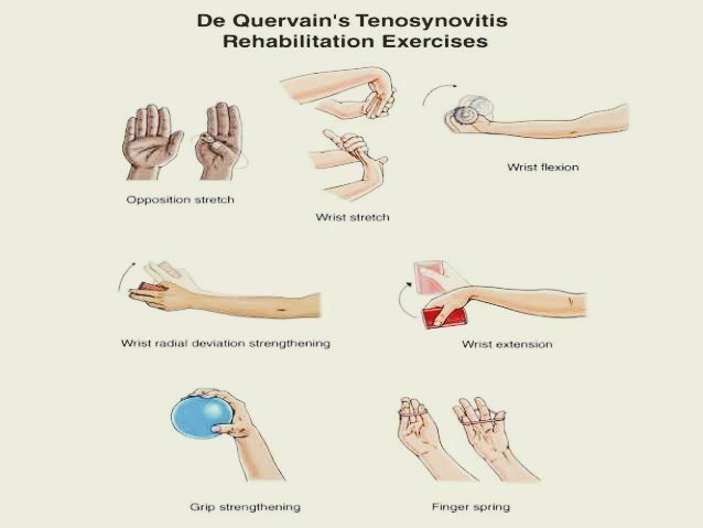 De Quervain’s Syndrome - Physio Pooja