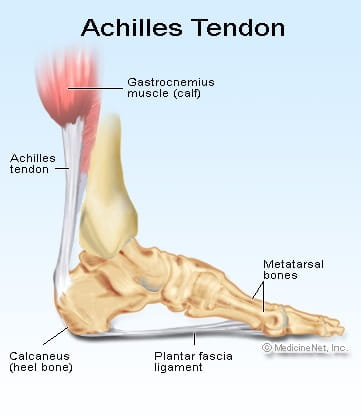 achilles-tendon-pain1