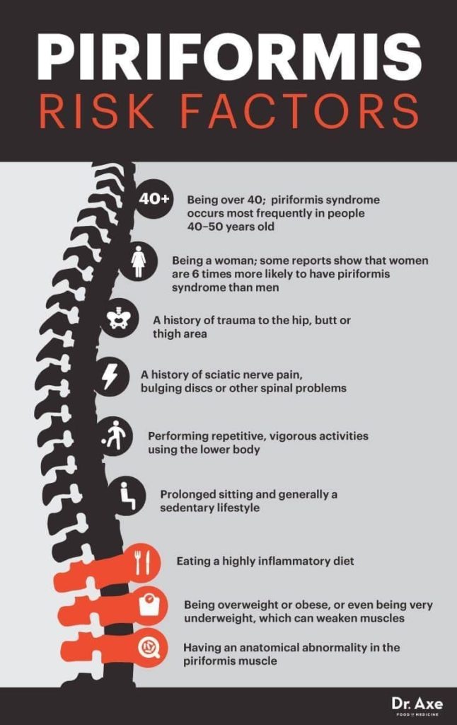 Piriformis Syndrome Exercise - Orthopaedic Spine Surgery Singapore